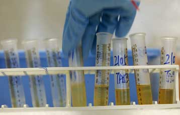 Πέντε σπρίντερ της Τζαμάικα θετικοί σε έλεγχο ντόπινγκ, επιβεβαίωσε και η IAAF