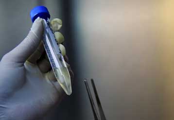 Και στο Χονγκ Κονγκ αναφέρθηκε κρούσμα νέας γρίπης με ανθεκτικότητα στο Tamiflu