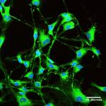 Αναπρογραμματισμένα πολυδύναμα κύτταρα επιδιορθώνουν βλάβες στην καρδιά μετά από έμφραγμα