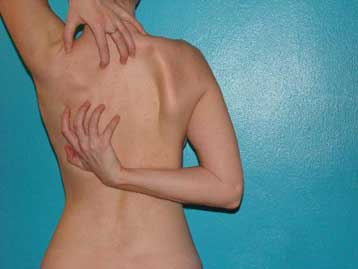 Το χρόνιο …ξύσιμο μπορεί τελικά να θεραπευτεί