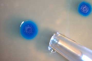 Μεταμόσχευση γονιδιώματος, εργαλείο για τη δημιουργία χρήσιμων μικροβίων