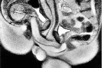 Μαγνητικές τομογραφίες αποκαλύπτουν την ανατομία του σεξ