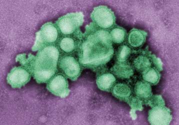 Μεταδοτική ακόμα και μετά την υποχώρηση του πυρετού η νέα γρίπη