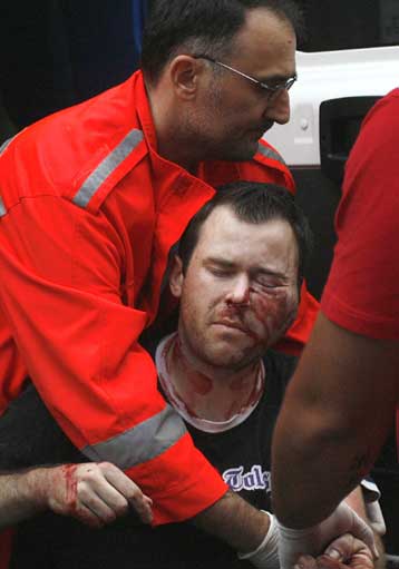 Σε κρίσιμη κατάσταση νοσηλεύεται στο Βελιγράδι ο φίλαθλος της Τουλούζ