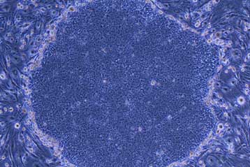 Πολύτιμη πηγή βλαστοκυττάρων τα ανεπιθύμητα «ψωμάκια»