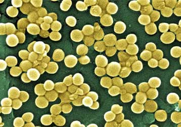 «Αχίλλειος πτέρνα» των βακτηρίων δίνει ελπίδες για ισχυρότερα αντιβιοτικά