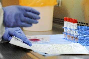 Νέα αιματολογικά τεστ υπόσχονται εύκολο εντοπισμό καρκίνων