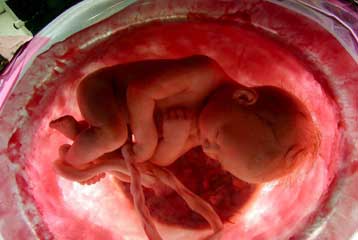 Ο καρκίνος μπορεί να μεταδοθεί από τη μητέρα στο έμβρυο