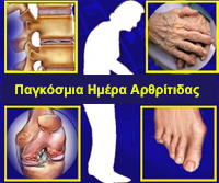 Αρθρίτιδα: Αντιμετωπίστε την έγκαιρα! Ζήστε καλύτερα