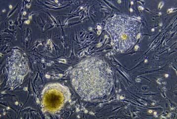 Βλαστικά κύτταρα τώρα και για εμβόλια κατά του καρκίνου