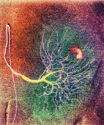 Ανακαλύφθηκαν αντισώματα που καταπολεμούν τις εσωτερικές αιμορραγίες