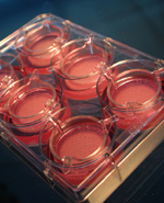 Νέα τεχνική δημιουργίας νέου δέρματος από βλαστοκύτταρα