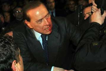 Αναρρώνει στο νοσοκομείο ο Σίλβιο Μπερλουσκόνι μετά την επίθεση που δέχτηκε