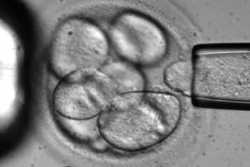 Παρτίδες «ηθικών» βλαστοκυττάρων από έμβρυα ενέκριναν οι ΗΠΑ