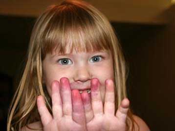 Η υπερβολική καθαριότητα των παιδιών… βλάπτει σοβαρά την υγεία τους