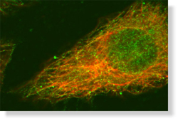 Πλήρης αποκωδικοποίηση του μελανώματος και του καρκίνου του μαστού