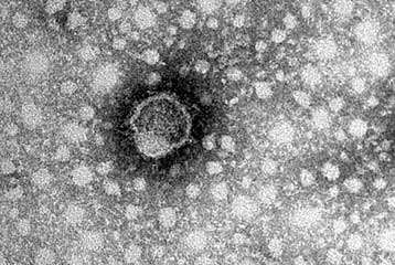 Γονίδια αρχαίου ιού διαιωνίζονται μέσα στο ανθρώπινο DNA