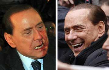 Ο Μπερλουσκόνι ξανά σε… δημόσια θέα μετά την επίθεση