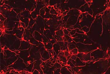 «Γιγάντιο άλμα» η απευθείας μετατροπή δερματικών κυττάρων σε νευρώνες