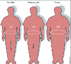 Αγνοούν τους κινδύνους της κοιλιακής παχυσαρκίας οι περισσότεροι άνθρωποι