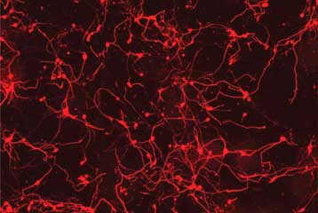 Κύτταρα δέρματος μετατράπηκαν απευθείας σε εγκεφαλικά κύτταρα