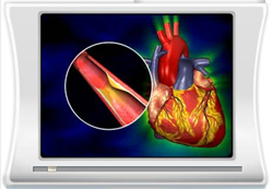 Τρισδιάστατες απεικονίσεις των στεφανιαίων αρτηριών υπόσχεται νέα διαγνωστική μέθοδος