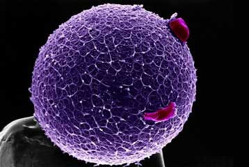 Αιματολογική εξέταση «μετράει πόσα ωάρια απομένουν στις γυναίκες»