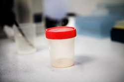 Φορητή συσκευή μετρά τον αριθμό των σπερματοζωαρίων