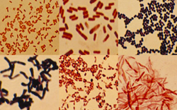 Το «πανόραμα» των εντερικών μικροβίων, δημιούργησε διεθνής επιστημονική ομάδα