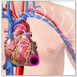 Λιγότερο «επιθετική» η θεραπεία του εμφράγματος στις γυναίκες