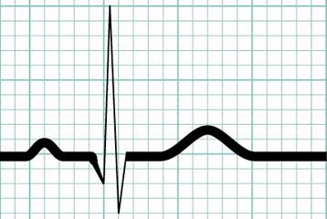 Οι περιθανάτιες εμπειρίες «συνδέονται με αυξημένα επίπεδα CO2 στο αίμα»