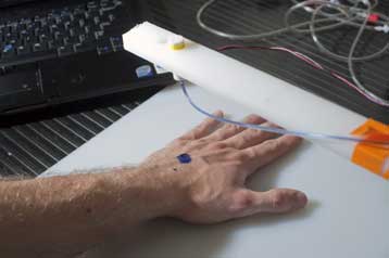 Σύστημα «βιοεκτυπωτή» καλύπτει πληγές και εγκαύματα με ζωντανά κύτταρα