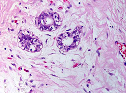 Νέα μέθοδος ανάπτυξης μαστού από βλαστοκύτταρα