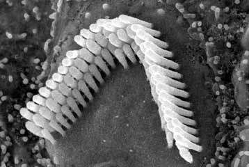 Βλαστικά κύτταρα θα μπορούσαν να θεραπεύουν την κώφωση