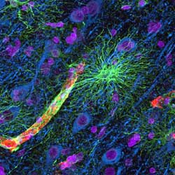 Τα αστροκύτταρα εμπλέκονται στις κρίσεις επιληψίας