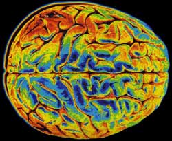 Ιχθυέλαιο, σωματική και πνευματική γυμναστική ενισχύουν το νου, αλλά δεν προλαμβάνουν τη νόσο Αλτσχάιμερ