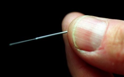 Φως στο μηχανισμό δράσης του βελονισμού