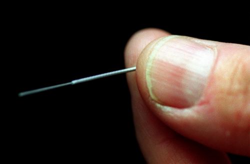 Φως στο μηχανισμό δράσης του βελονισμού