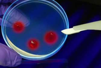 Εντοπίστηκαν και νέα γονίδια που σχετίζονται με τον αυτισμό