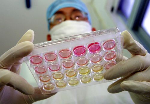 Γονιδιακή θεραπεία δίνει ενθαρρυντικά αποτελέσματα κατά του HIV