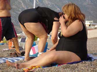 Η παχυσαρκία συντελεί στην αύξηση των εγκεφαλικών επεισοδίων στις γυναίκες