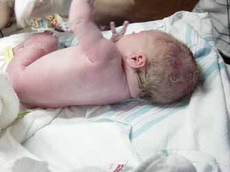 Κίνδυνος περιγεννητικού θανάτου για τους βραδινούς τοκετούς