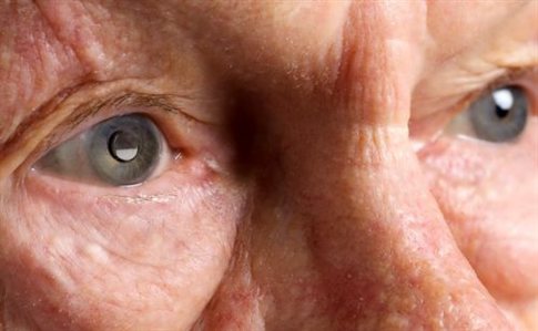 Εμφυτεύσιμο τηλεσκόπιο για την αποκατάσταση της όρασης εγκρίθηκε στις ΗΠΑ