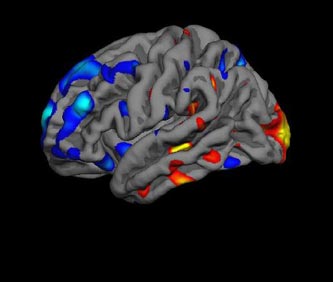 Γρήγορη διάγνωση του αυτισμού υπόσχεται η μαγνητική τομογραφία