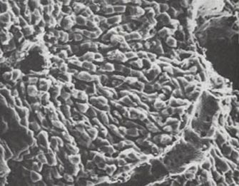 Ηπατικά κύτταρα από ανθρώπινο δέρμα δημιούργησαν Βρετανοί ερευνητές