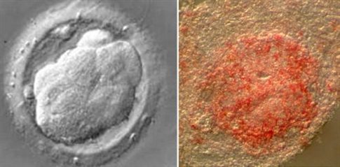 Αντιδρά ο Λευκός Οίκος στο πάγωμα της επιχορήγησης της έρευνας στα βλαστοκύτταρα