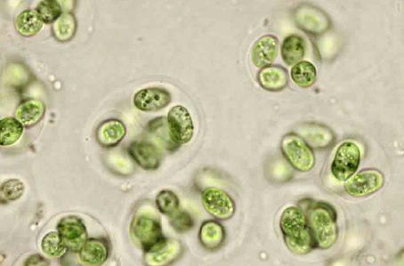 Μικρόβια από την ύπαιθρο επιζούν ενάμισι χρόνο στο κενό του Διαστήματος