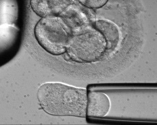 Αμερικανικό δικαστήριο παγώνει κρατικές έρευνες σε εμβρυικά βλαστοκύτταρα