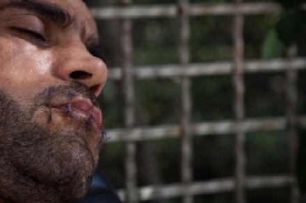 Πολιτικό άσυλο για τους έξι Ιρανούς απεργούς πείνας