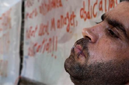 Στο νοσοκομείο σε σοβαρή κατάσταση ένας εκ των Ιρανών απεργών πείνας